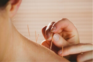 ProActive Physiotherapy in Edmonton, AB offers acupuncture.