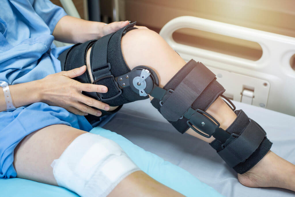 A person with a knee brace. Call ProActive Physiotherapy in Edmonton, AB today to learn more about rehab!!